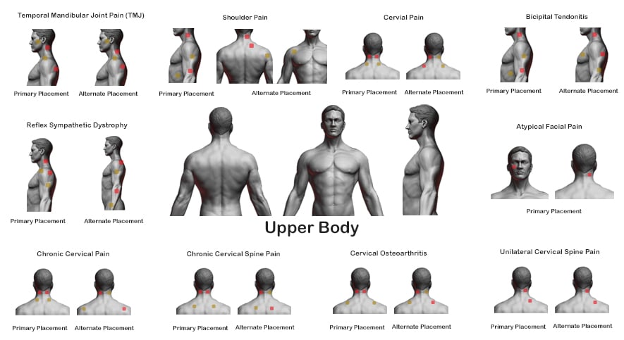 Upper body TENS pad placement guide