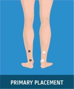 Lower Leg Pain (Diabetic Neuropathy)