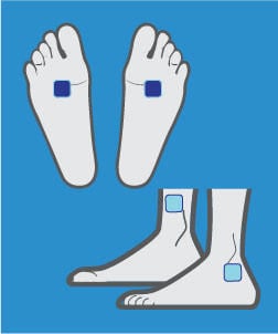 Using TENS for Diabetic Neuropathy, pad placement 